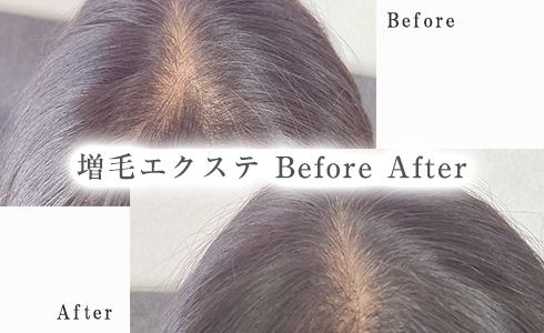 Before After