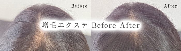 Before After