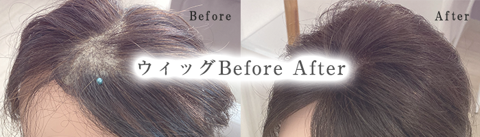 ヘアウィッグ Before After