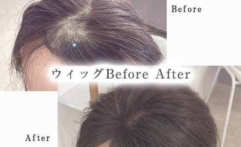 ヘアウィッグ Before After