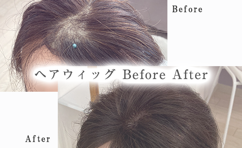 ヘアウィッグ Before After